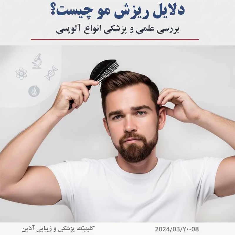 دلایل ریزش مو؛ بررسی تخصصی علل پزشکی، هورمونی و ژنتیکی آلوپسی